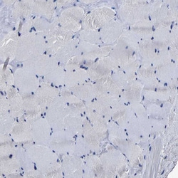 Invitrogen AASS Polyclonal Antibody 100 &mu;L; Unconjugated:Antibodies,