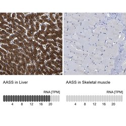 Invitrogen AASS Polyclonal Antibody 100 &mu;L; Unconjugated:Antibodies,