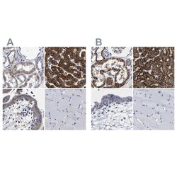 Invitrogen AASS Polyclonal Antibody 100 &mu;L; Unconjugated:Antibodies,
