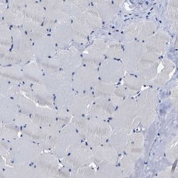 Invitrogen AASS Polyclonal Antibody 100 &mu;L; Unconjugated:Antibodies,