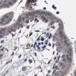 Invitrogen AASS Polyclonal Antibody 100 &mu;L; Unconjugated:Antibodies,