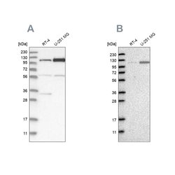 Invitrogen AASS Polyclonal Antibody 100 &mu;L; Unconjugated:Antibodies,