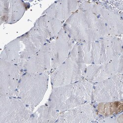 Invitrogen SQLE Polyclonal Antibody 100 &mu;L; Unconjugated:Anticorps,