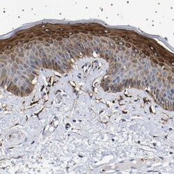 Invitrogen SQLE Polyclonal Antibody 100 &mu;L; Unconjugated:Anticorps,