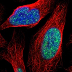Invitrogen ZNF250 Polyclonal Antibody 100 &mu;L; Unconjugated:Antibodies,
