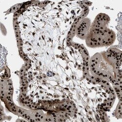 Invitrogen ZNF250 Polyclonal Antibody 100 &mu;L; Unconjugated:Antibodies,