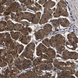 Invitrogen PPM1K Polyclonal Antibody 100 &mu;L; Unconjugated:Antibodies,
