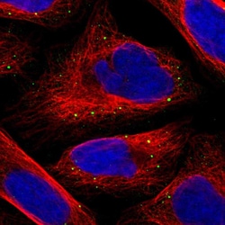 Invitrogen SFXN4 Polyclonal Antibody 100 &mu;L; Unconjugated:Antibodies,