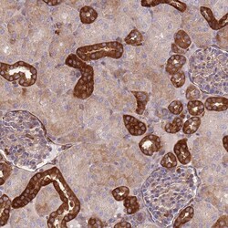 Invitrogen ZNF237 Polyclonal Antibody 100 &mu;L; Unconjugated:Antibodies,