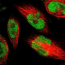 Invitrogen METTL1 Polyclonal Antibody 100 &mu;L; Unconjugated:Antibodies,