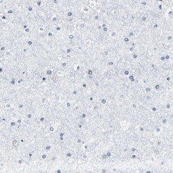 Invitrogen METTL1 Polyclonal Antibody 100 &mu;L; Unconjugated:Antibodies,