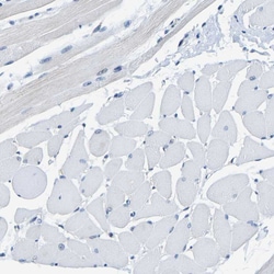 Invitrogen METTL1 Polyclonal Antibody 100 &mu;L; Unconjugated:Antibodies,