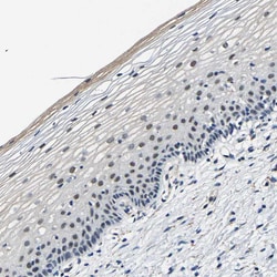 Invitrogen METTL1 Polyclonal Antibody 100 &mu;L; Unconjugated:Antibodies,
