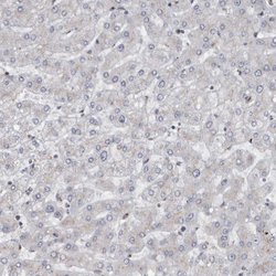 Invitrogen ZMYND8 Polyclonal Antibody 100 &mu;L | Buy Online | Invitrogen&trade; | Fisher Scientific