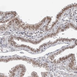 Invitrogen ZMYND8 Polyclonal Antibody 100 &mu;L | Buy Online | Invitrogen&trade; | Fisher Scientific