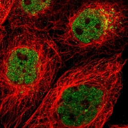 Invitrogen ZMYND8 Polyclonal Antibody 100 &mu;L | Buy Online | Invitrogen&trade; | Fisher Scientific