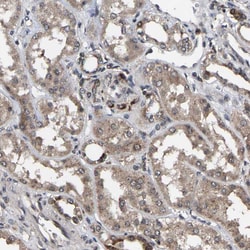 Invitrogen HAUS6 Polyclonal Antibody 100 &mu;L | Buy Online | Invitrogen&trade; | Fisher Scientific
