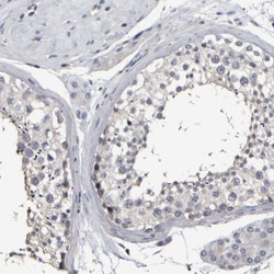 Invitrogen MURC Polyclonal Antibody 100 &mu;L; Unconjugated:Antibodies,