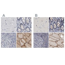 Invitrogen MURC Polyclonal Antibody 100 &mu;L; Unconjugated:Antibodies,