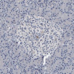 Invitrogen MURC Polyclonal Antibody 100 &mu;L; Unconjugated:Antibodies,