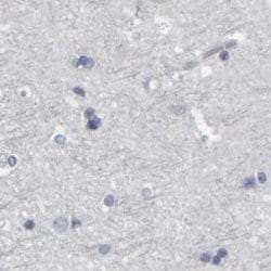 Invitrogen MURC Polyclonal Antibody 100 &mu;L; Unconjugated:Antibodies,