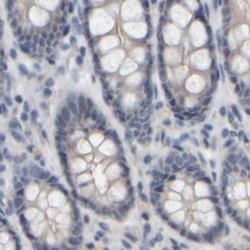 Invitrogen MURC Polyclonal Antibody 100 &mu;L; Unconjugated:Antibodies,