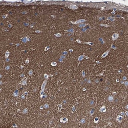 Invitrogen KIAA1045 Polyclonal Antibody 100 &mu;L; Unconjugated:Antibodies,