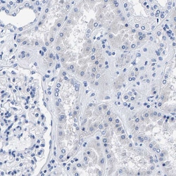 Invitrogen KIAA1045 Polyclonal Antibody 100 &mu;L; Unconjugated:Antibodies,