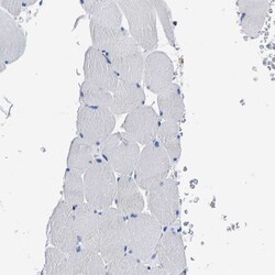 Invitrogen KIAA1045 Polyclonal Antibody 100 &mu;L; Unconjugated:Antibodies,