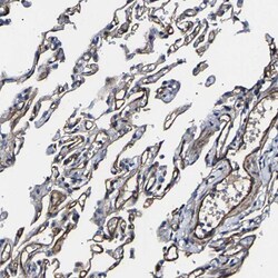 Invitrogen KLHDC5 Polyclonal Antibody 100 &mu;L; Unconjugated:Antibodies,