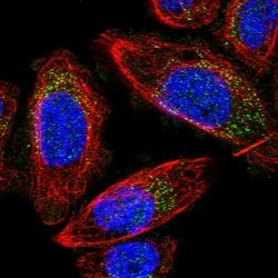 Invitrogen MRPS24 Polyclonal Antibody 100 &mu;L; Unconjugated:Antibodies,