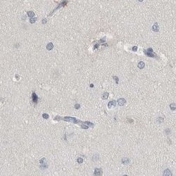 Invitrogen MURC Polyclonal Antibody 100 &mu;L | Buy Online | Invitrogen&trade; | Fisher Scientific