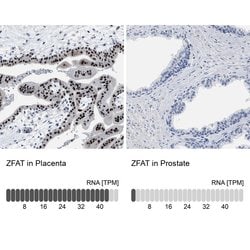 Invitrogen ZFAT Polyclonal Antibody 100 &mu;L | Buy Online | Invitrogen&trade; | Fisher Scientific