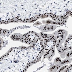 Invitrogen ZFAT Polyclonal Antibody 100 &mu;L | Buy Online | Invitrogen&trade; | Fisher Scientific