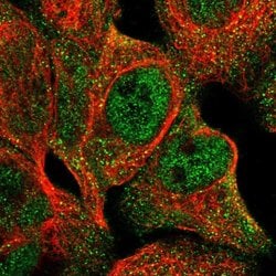 Invitrogen CSGlcAT Polyclonal Antibody 100 &mu;L; Unconjugated:Antibodies,