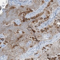 Invitrogen CSGlcAT Polyclonal Antibody 100 &mu;L; Unconjugated:Antibodies,