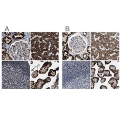 Invitrogen HIBADH Polyclonal Antibody 100 &mu;L; Unconjugated:Antibodies,
