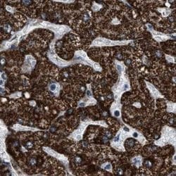 Invitrogen HIBADH Polyclonal Antibody 100 &mu;L; Unconjugated:Antibodies,