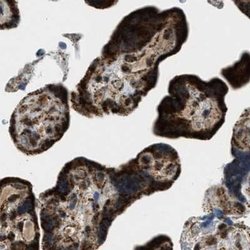 Invitrogen HIBADH Polyclonal Antibody 100 &mu;L; Unconjugated:Antibodies,