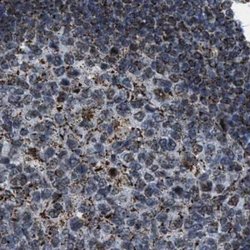 Invitrogen HIBADH Polyclonal Antibody 100 &mu;L; Unconjugated:Antibodies,