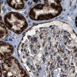 Invitrogen HIBADH Polyclonal Antibody 100 &mu;L; Unconjugated:Antibodies,