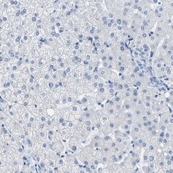 Invitrogen MYBPC1 Polyclonal Antibody 100 &mu;L | Buy Online | Invitrogen&trade; | Fisher Scientific