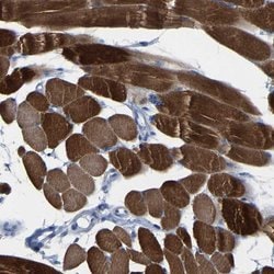 Invitrogen MYBPC1 Polyclonal Antibody 100 &mu;L | Buy Online | Invitrogen&trade; | Fisher Scientific