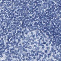 Invitrogen MYBPC1 Polyclonal Antibody 100 &mu;L | Buy Online | Invitrogen&trade; | Fisher Scientific