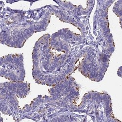 Invitrogen POP7 Polyclonal Antibody 100 &mu;L; Unconjugated:Antibodies,