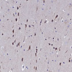 Invitrogen POP7 Polyclonal Antibody 100 &mu;L; Unconjugated:Antibodies,