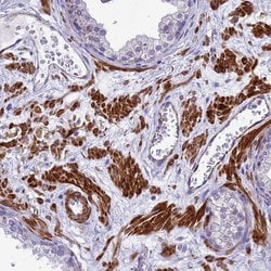 Invitrogen POP7 Polyclonal Antibody 100 &mu;L; Unconjugated:Antibodies,