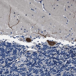 Invitrogen FGL2 Polyclonal Antibody 100 &mu;L; Unconjugated:Antibodies,