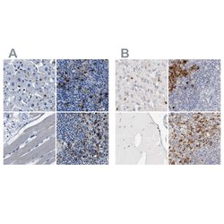 Invitrogen FGL2 Polyclonal Antibody 100 &mu;L; Unconjugated:Antibodies,