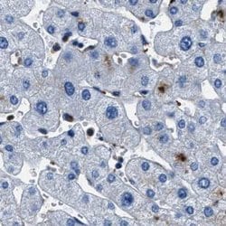 Invitrogen FGL2 Polyclonal Antibody 100 &mu;L; Unconjugated:Antibodies,